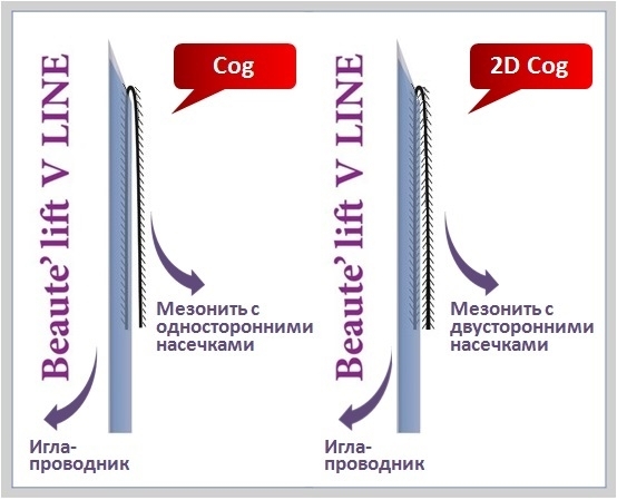 мезонити Beaute’ lift V LINE с насечками Cog 1модификации cog